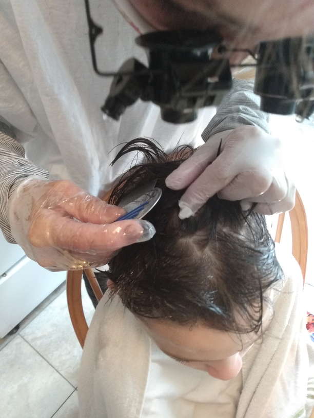 Head Lice Treatment Removal Service in Pearland, Texas LiceDoctors
